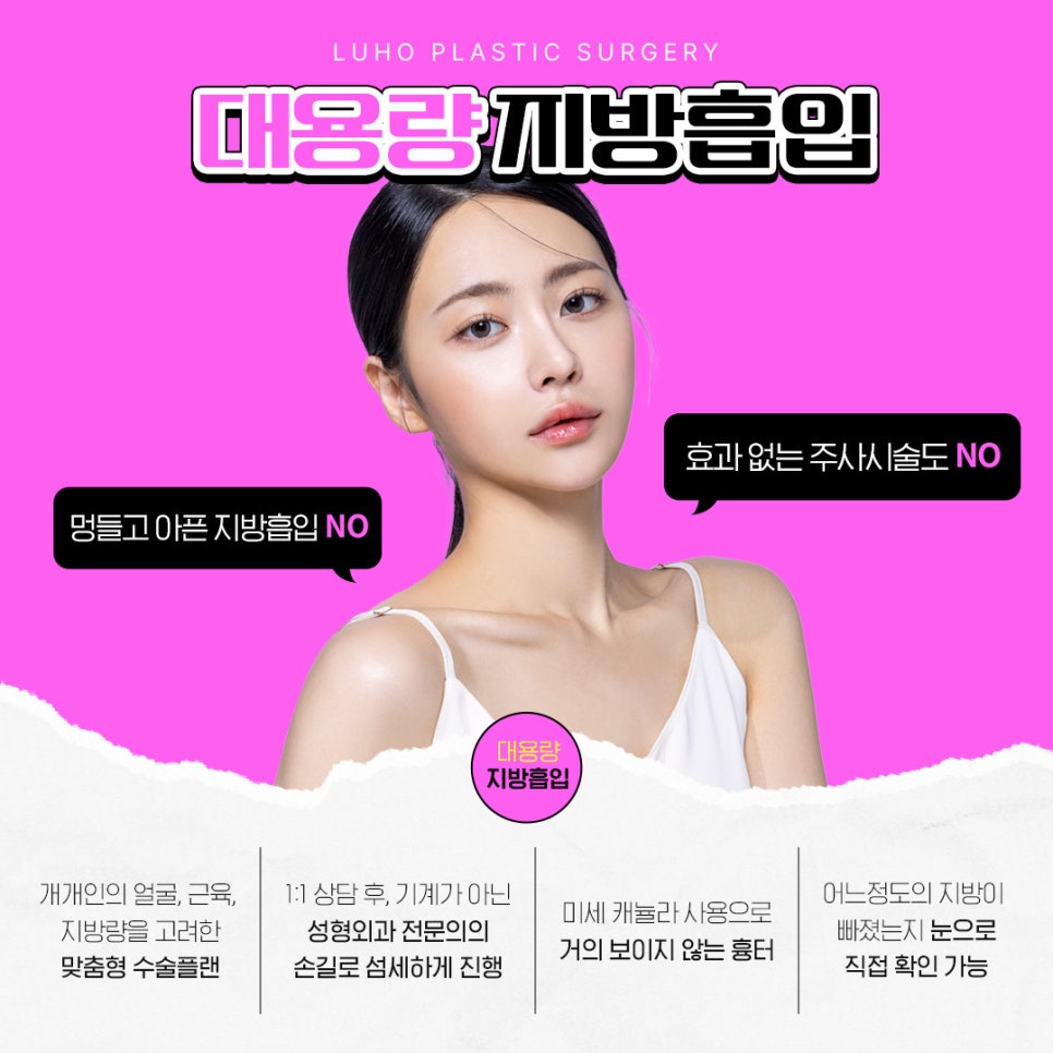 Large-Volume Facial Liposuction at Ruho Plastic Surgery image 4