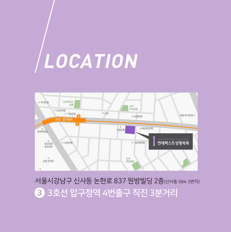 눈성형 관련 이미지 4