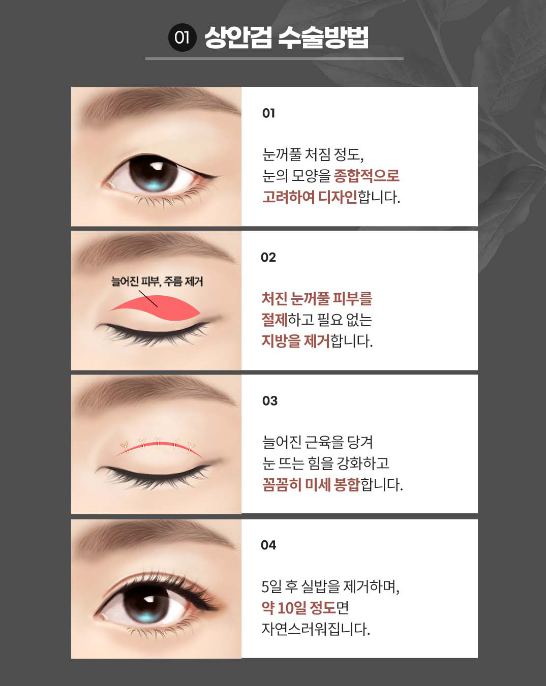 ［루호성형외과］꽃보다중년 동안성형🌹 관련 이미지 4