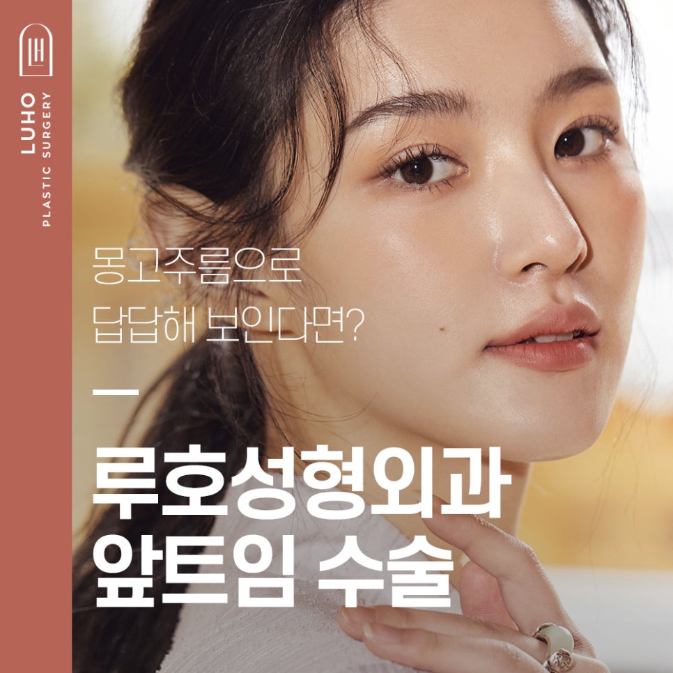 Inner Corner Epicanthoplasty for a Brighter Eye Shape image 1