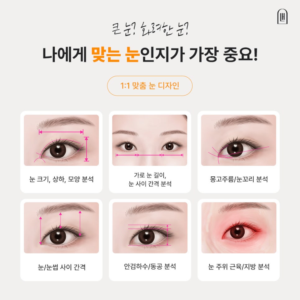 신사역 눈성형으로 완성한 또렷한 눈매, 눈꼬리까지 달라진 변화 관련 이미지 4