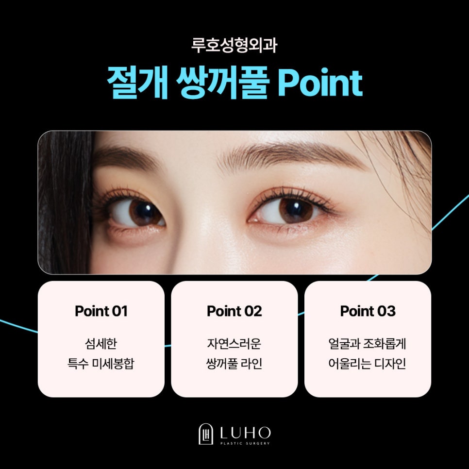 두꺼운 눈꺼풀, 신사역 절개쌍꺼풀로 개선한 후기 관련 이미지 5