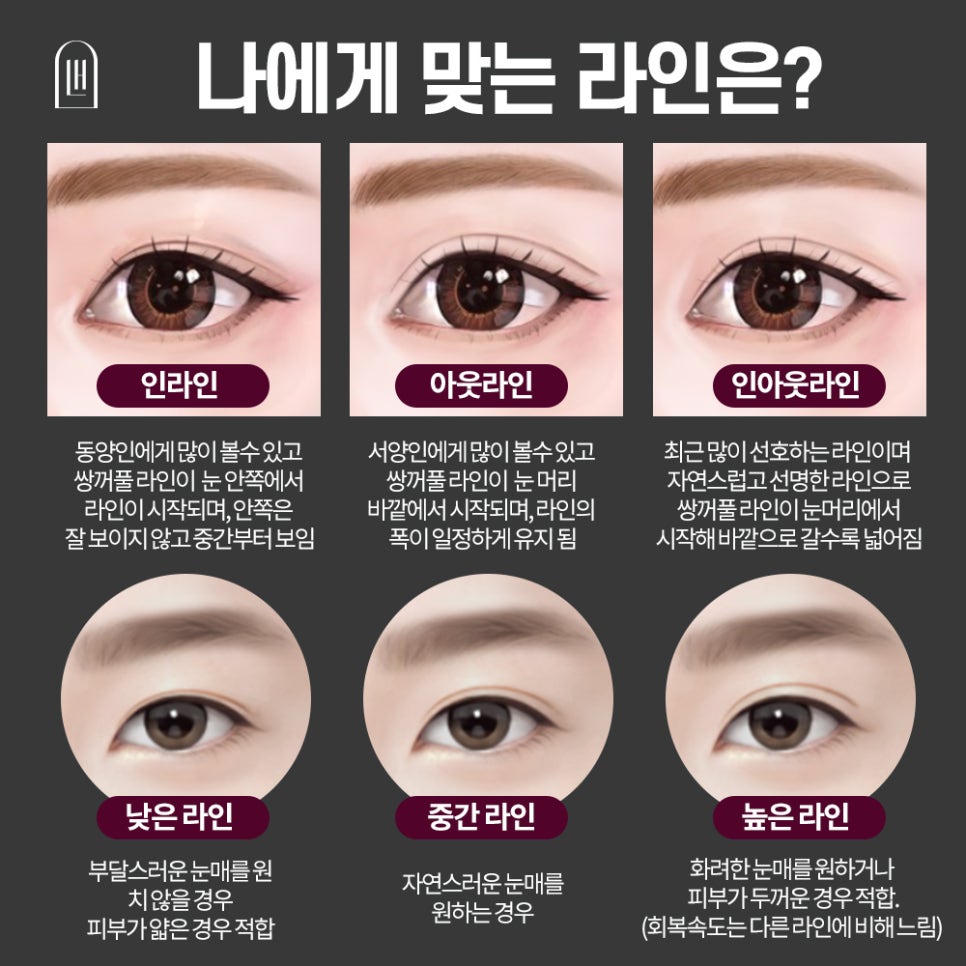 자연유착쌍꺼풀수술,내가 원하는 눈으로 루호에서 관련 이미지 5