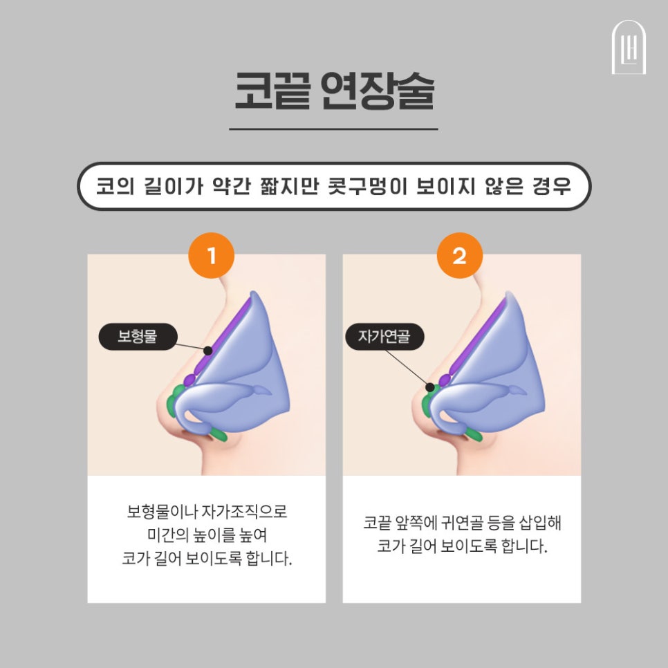 짧은코 들창코를 세련된 코로 관련 이미지 5