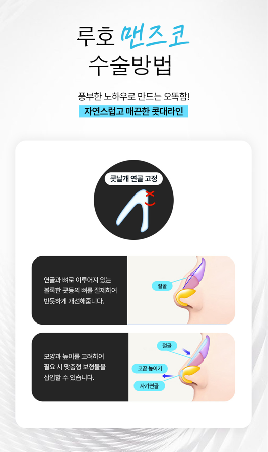 남다른 라인을 만들어 낸 신사역남자 코성형 전후 비교 관련 이미지 4