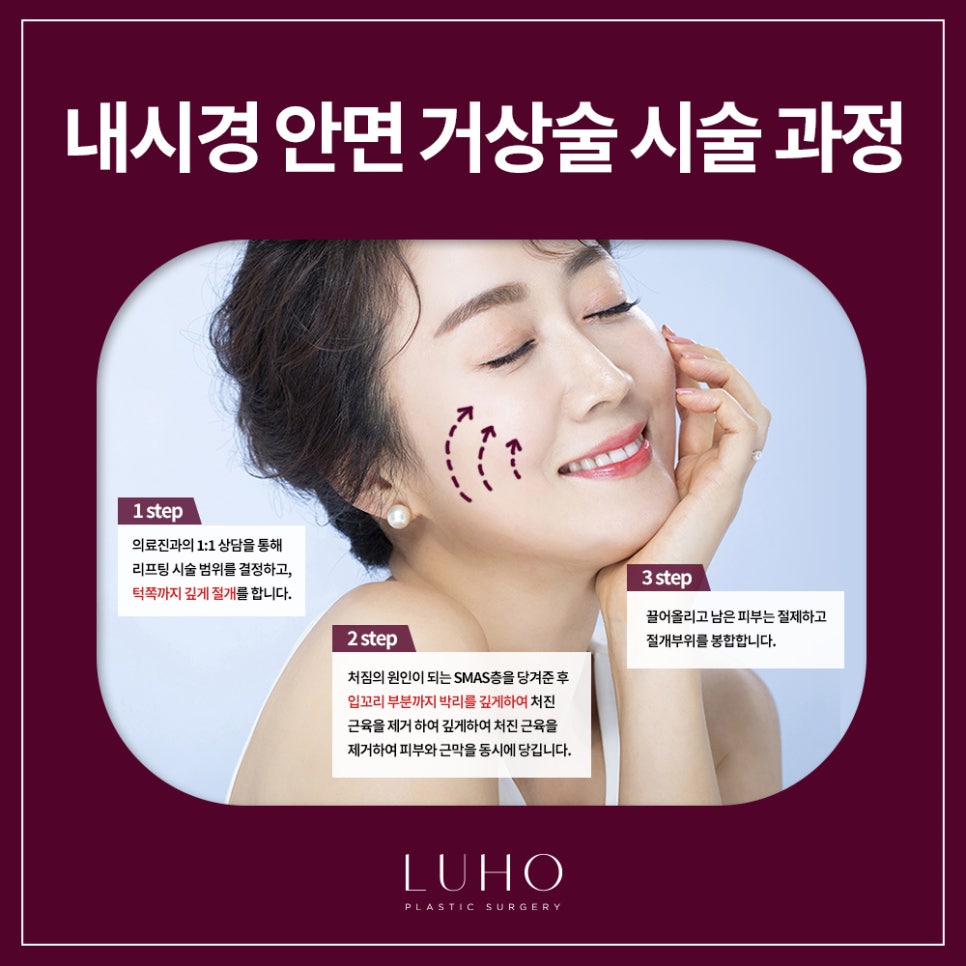 Facelift Surgery image 2