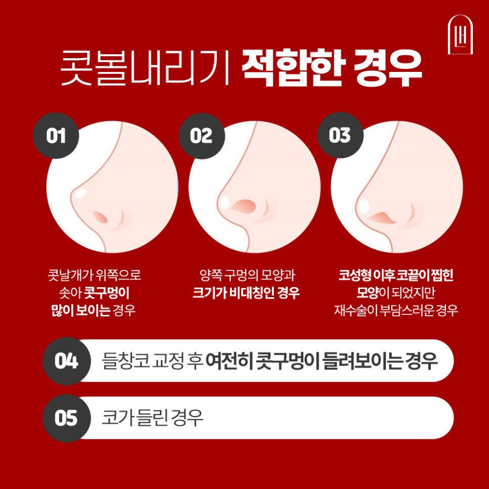 콧날개는 Down! 외모는 Up! 관련 이미지 3