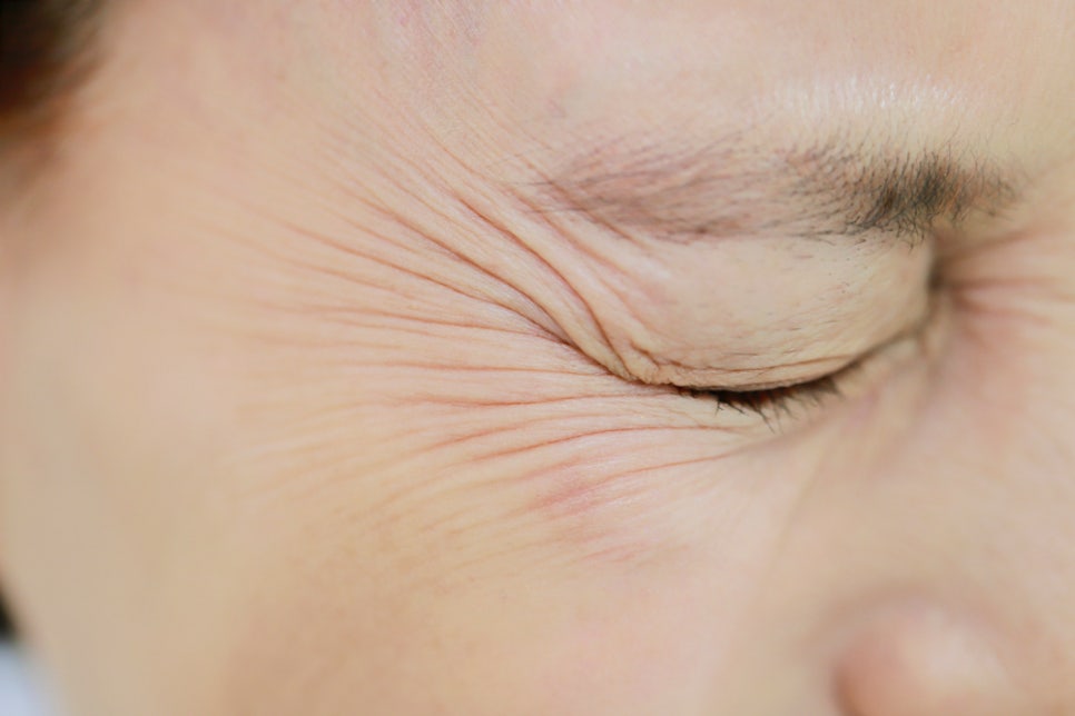 신사역 스킨보톡스 처음이면 꼭 읽어야 할 A to Z 관련 이미지 3