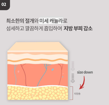 [Luho Plastic Surgery] High-Volume Half-Face Liposuction image 8