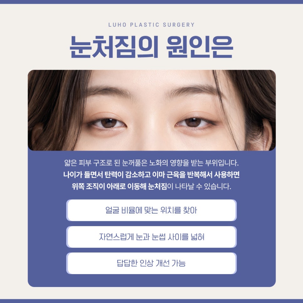A Brighter Impression with an Endoscopic Forehead Lift to Correct Drooping Eyebrows image 2