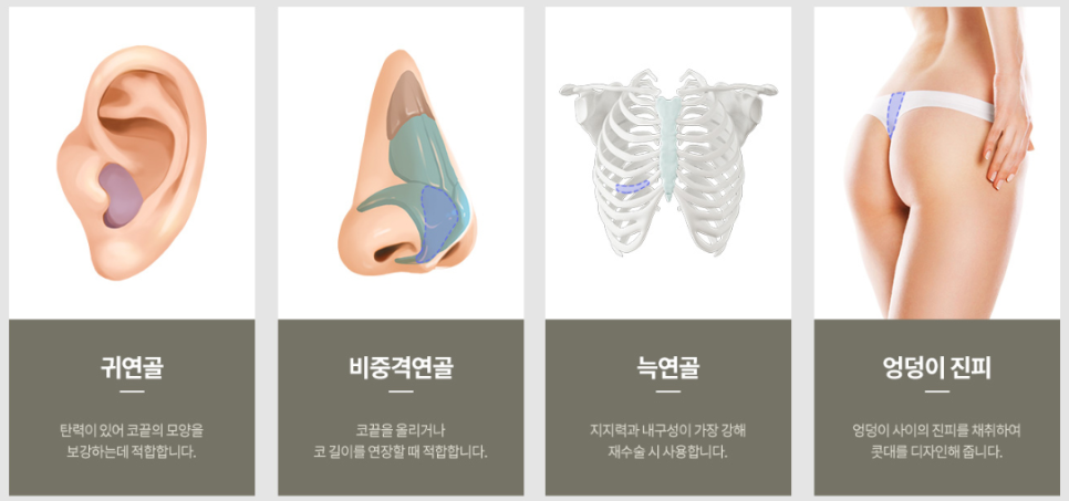 신사역 복코 재수술 전후 : 얄쌍한 콧대로 바뀐 사례 관련 이미지 5