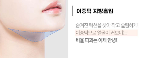 [Luho Plastic Surgery] High-Volume Half-Face Liposuction image 3