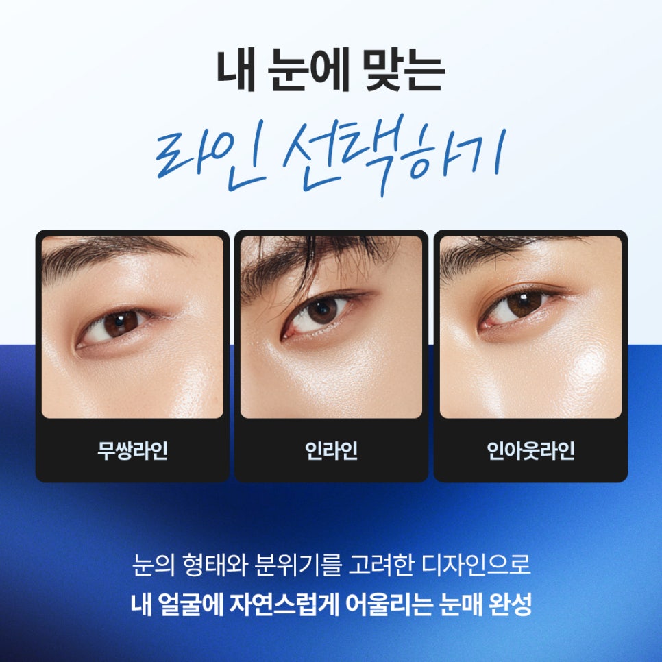 답답해 보이는 눈을 선명하게 만든 신사역남자눈성형 전후 관련 이미지 3