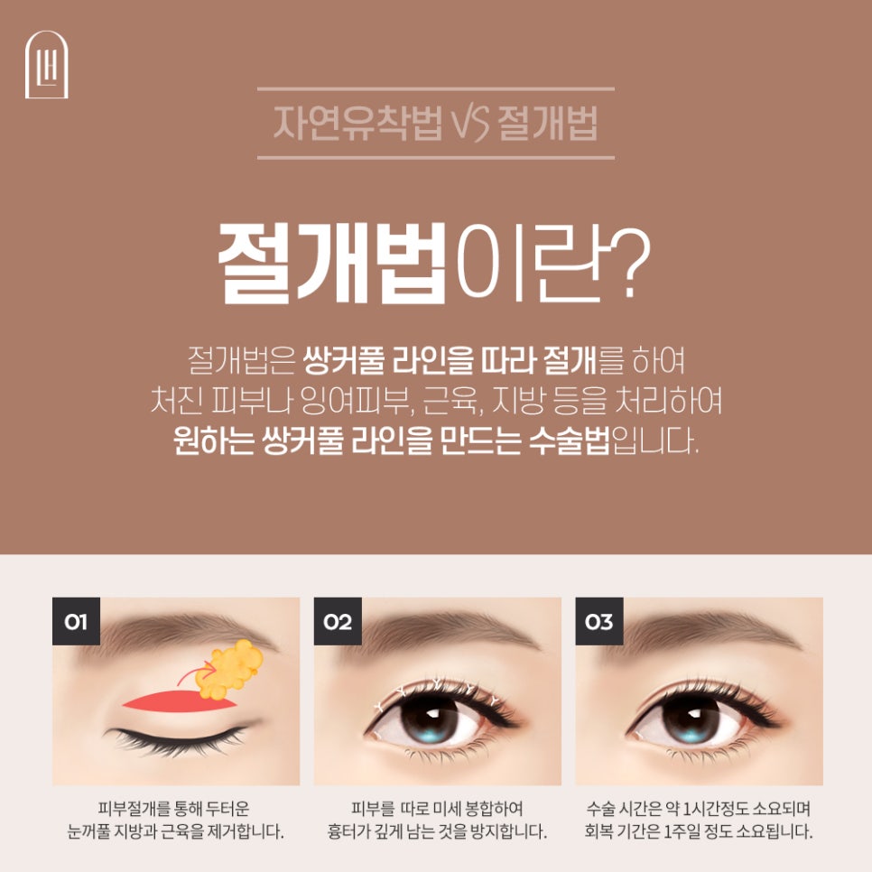 비절개쌍수 절개법과 다르점은 관련 이미지 4
