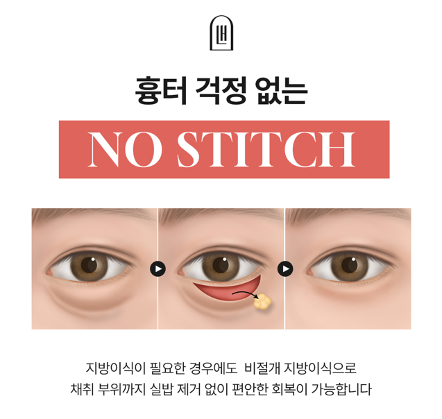 After Men’s Under-Eye Surgery at Sinsa Station That Reduced Dark Circles and Added Vitality image 4