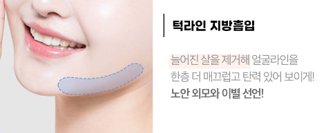 [Luho Plastic Surgery] High-Volume Half-Face Liposuction image 5