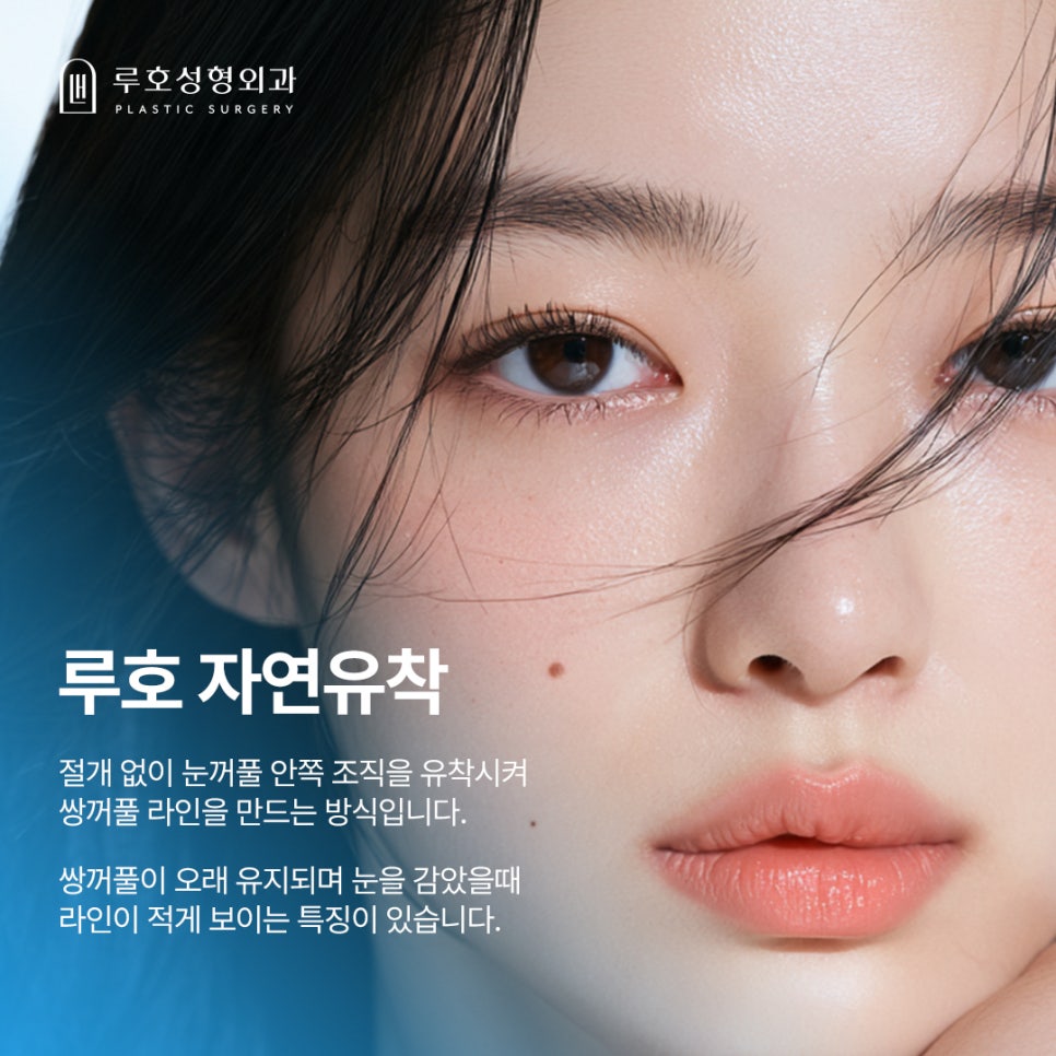 쌍꺼풀 수술, 티는 덜 나고 눈은 또렷하게? 자연유착 Q&A 관련 이미지 2