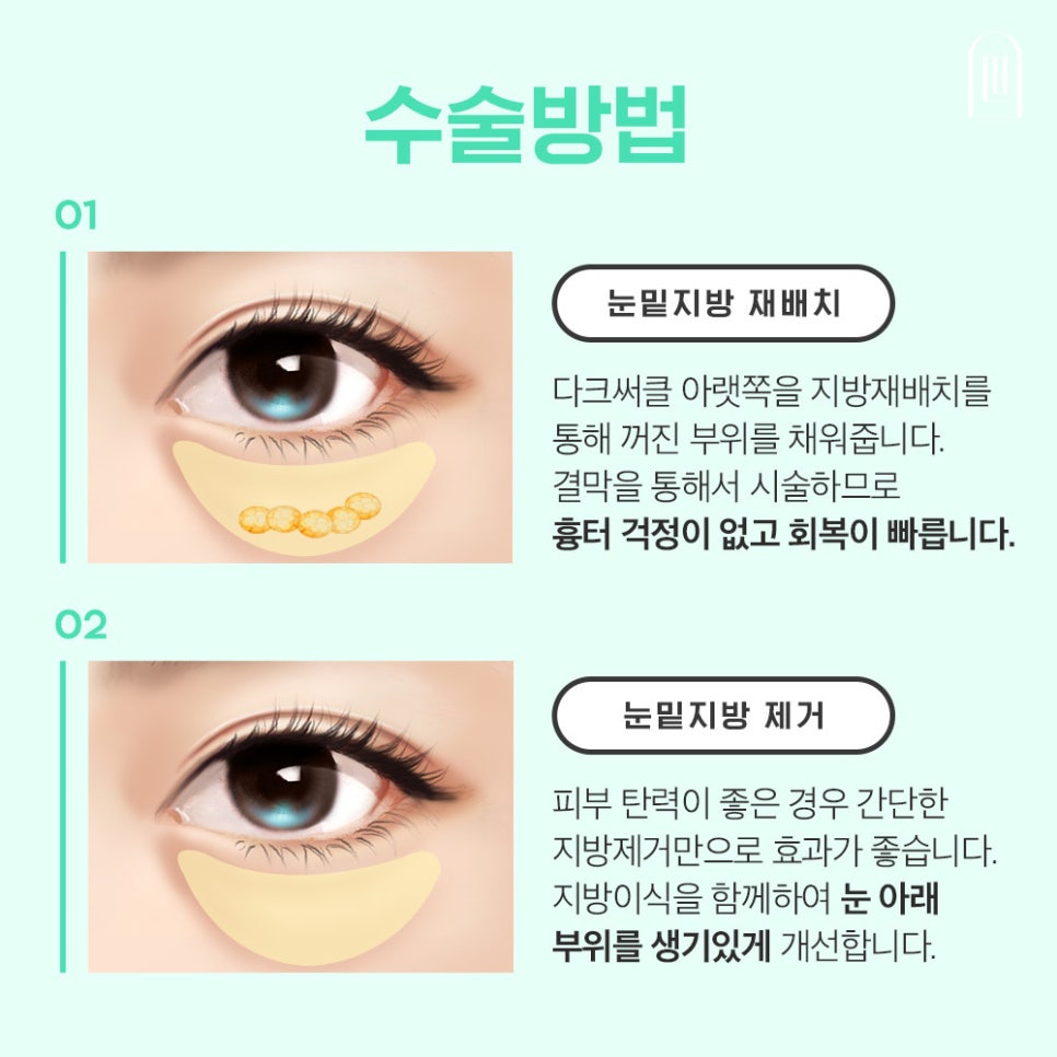 눈밑지방재배치로 환해지고 밝아진 얼굴로 관련 이미지 4