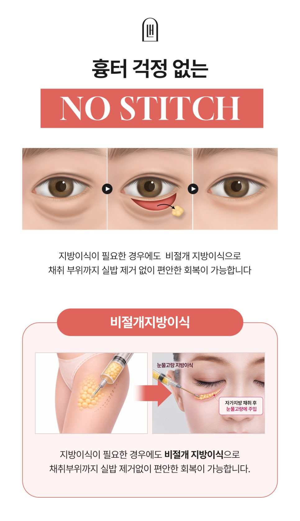 인상을 칙칙하게 만드는 다크서클 잡은 눈밑지 사례 관련 이미지 5