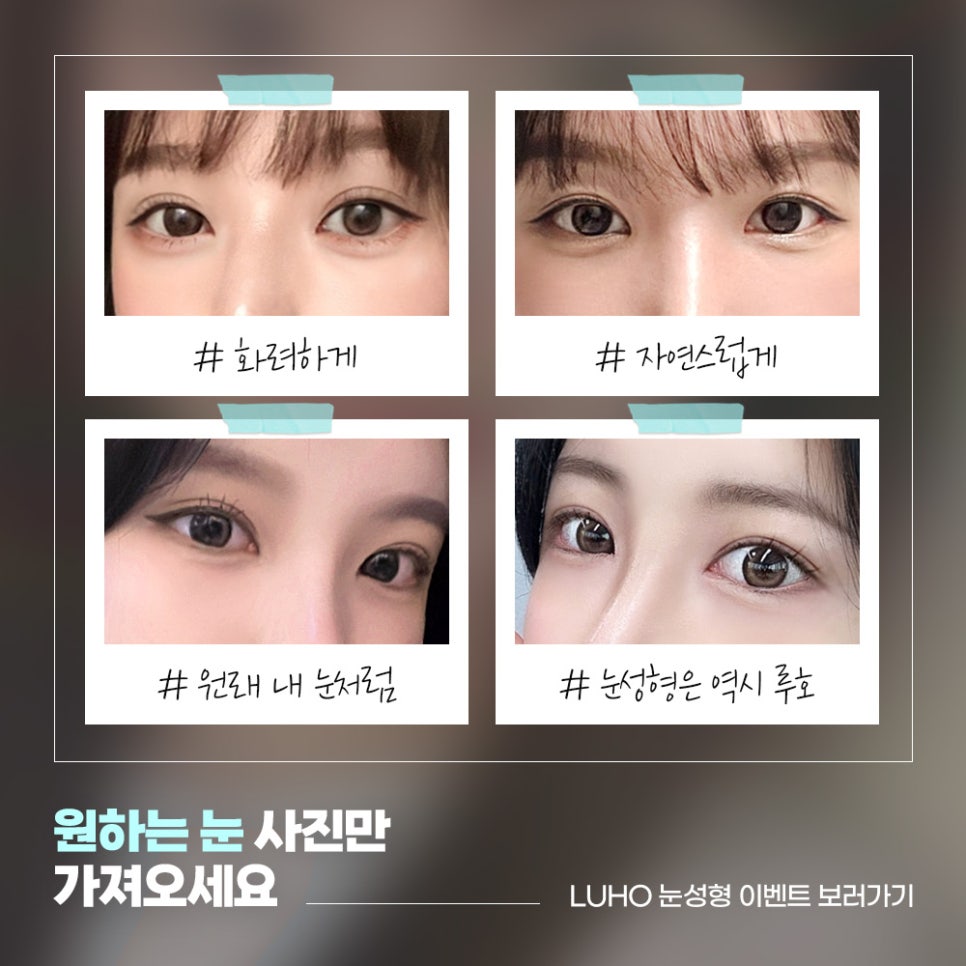 ［Luho Plastic Surgery］The HOT Girl Group Eyes of Today image 4
