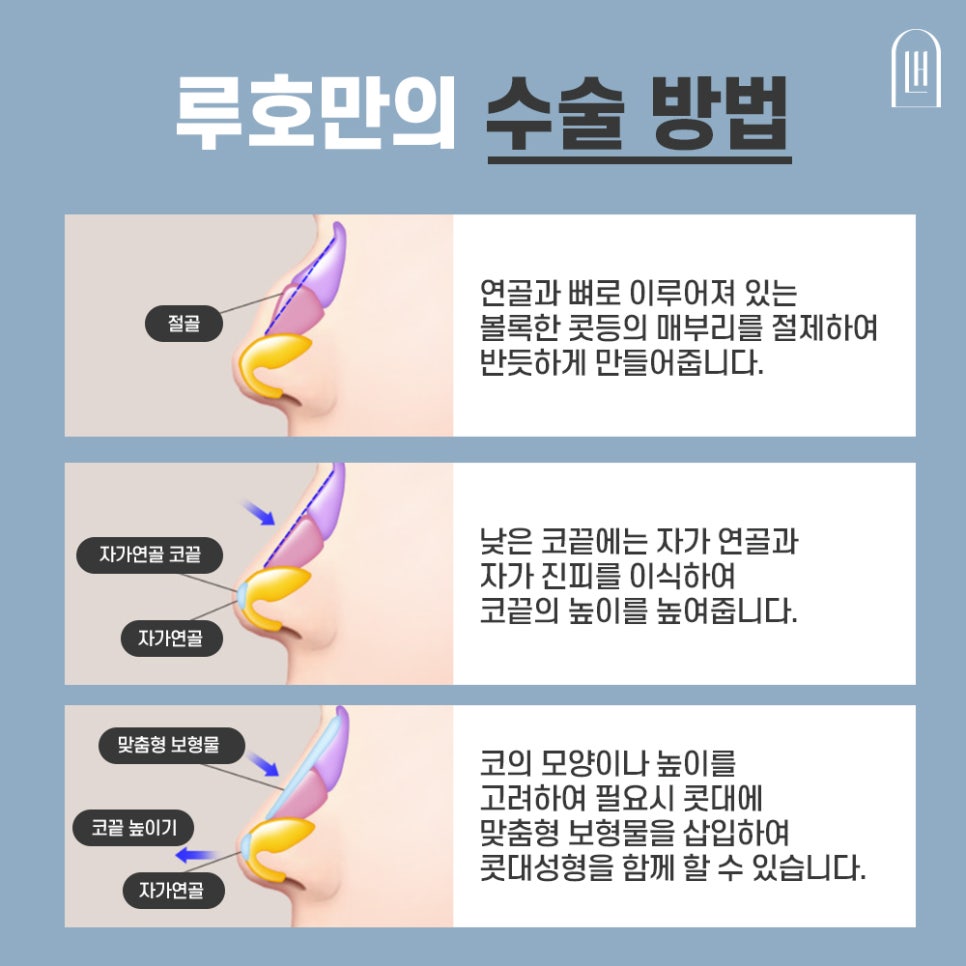 정리정돈된 코라인, 매부리코 교정 관련 이미지 3