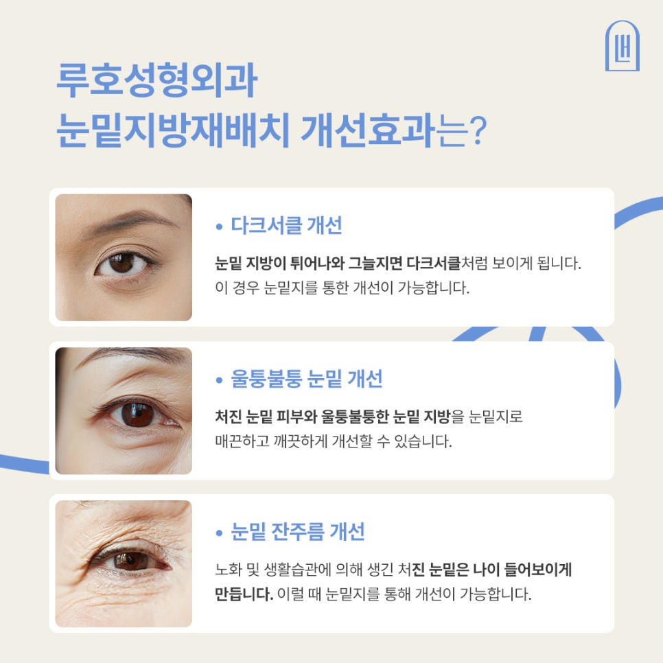 Sinsa Station Under-Eye Fat Repositioning Clinic: Dark Circles + Review of Improvement for Uneven Under-Eyes image 4