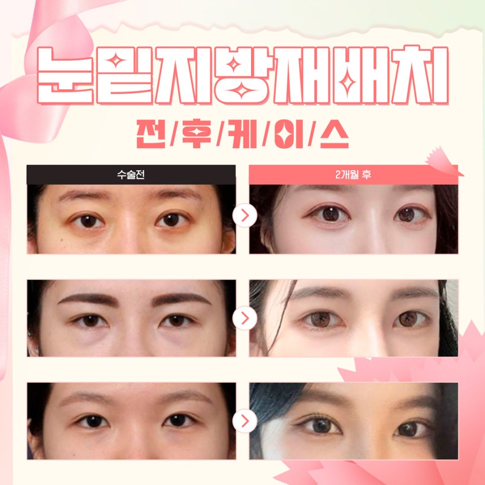🌺루호성형외과 5월 가정의 달 효도 이벤트💐 관련 이미지 5