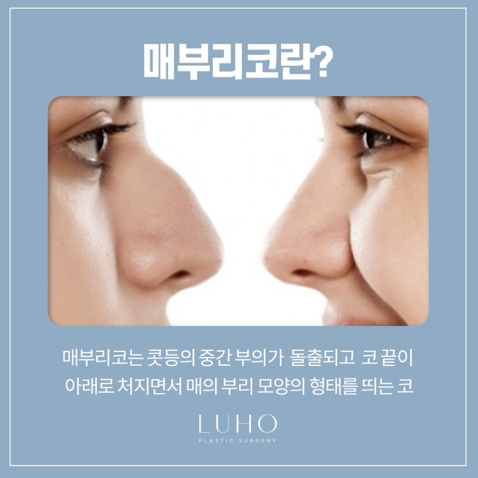 정리정돈된 코라인, 매부리코 교정 관련 이미지 2