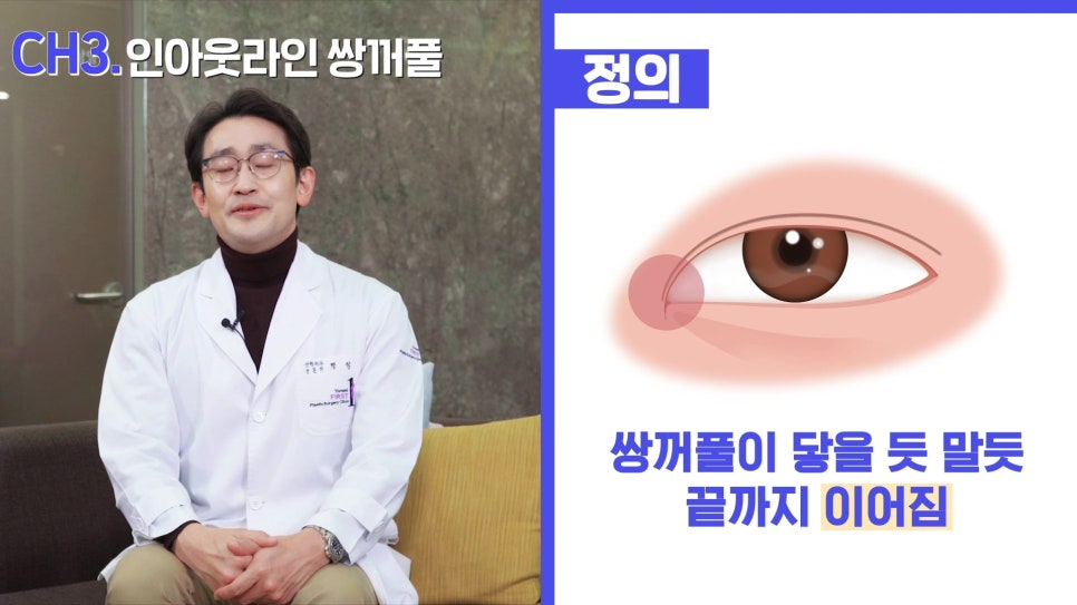 나에게 맞는 쌍커풀 라인은? - 아성원 관련 이미지 14