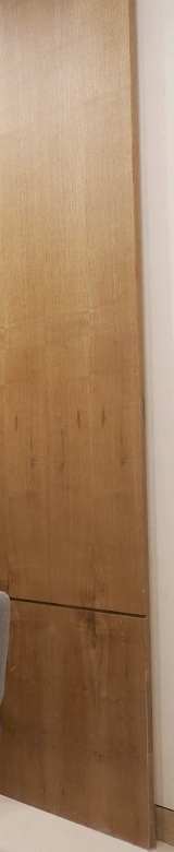 휘어진 코를 바르게 신사역 휜코수술 후기 관련 이미지 13