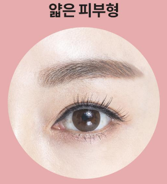 ［루호성형외과］어두운 눈 밑을 환하게-눈밑지방재배치 관련 이미지 12