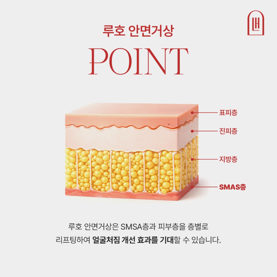 마리오네트 주름 해결한 신사역 안면거상술 효과 관련 이미지 4
