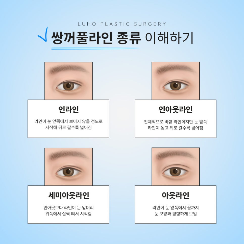수술 후기로 파악하는 쌍꺼풀 잘하는 병원 기준 관련 이미지 2