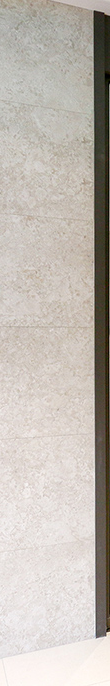 What Are the Key Points Before and After Eyelid Correction at Apgujeong Station? image 9