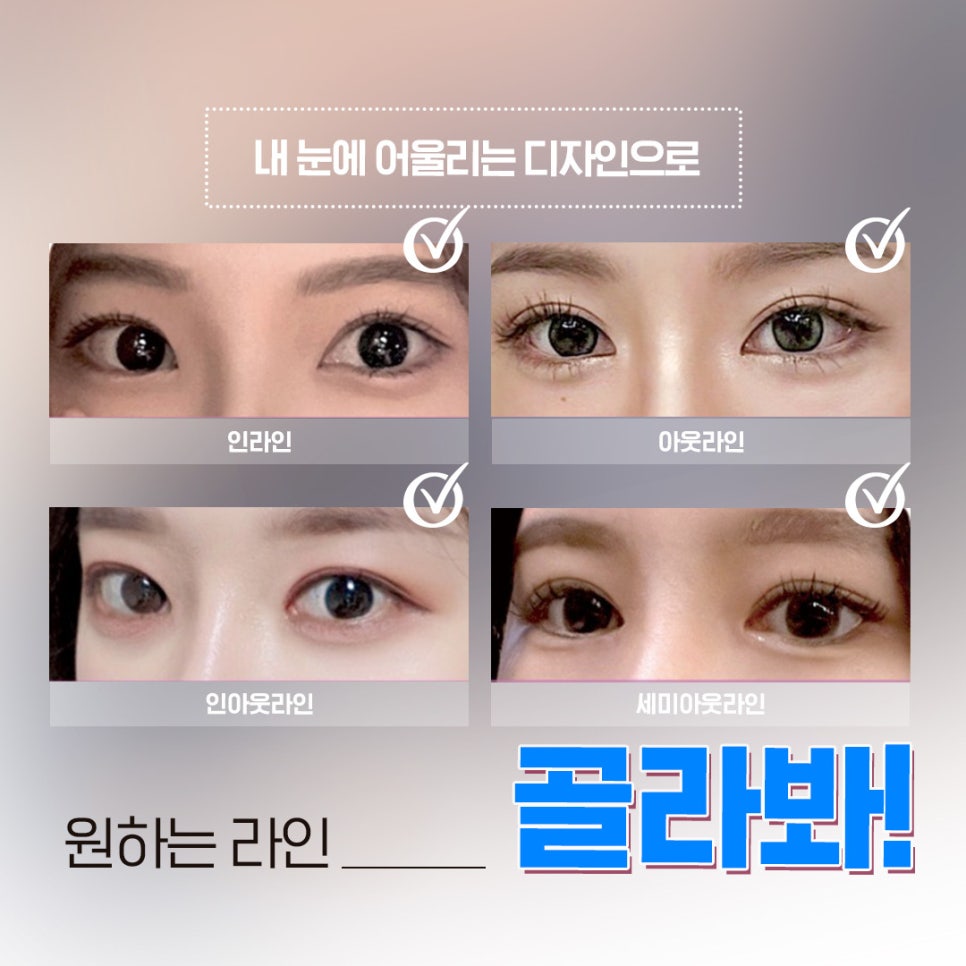 Ruho Plastic Surgery Natural Adhesion Eye Surgery image 2