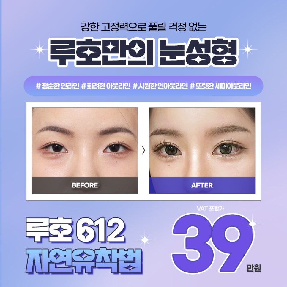 [Ruho Plastic Surgery] New Year Maximum Discount Event image 2