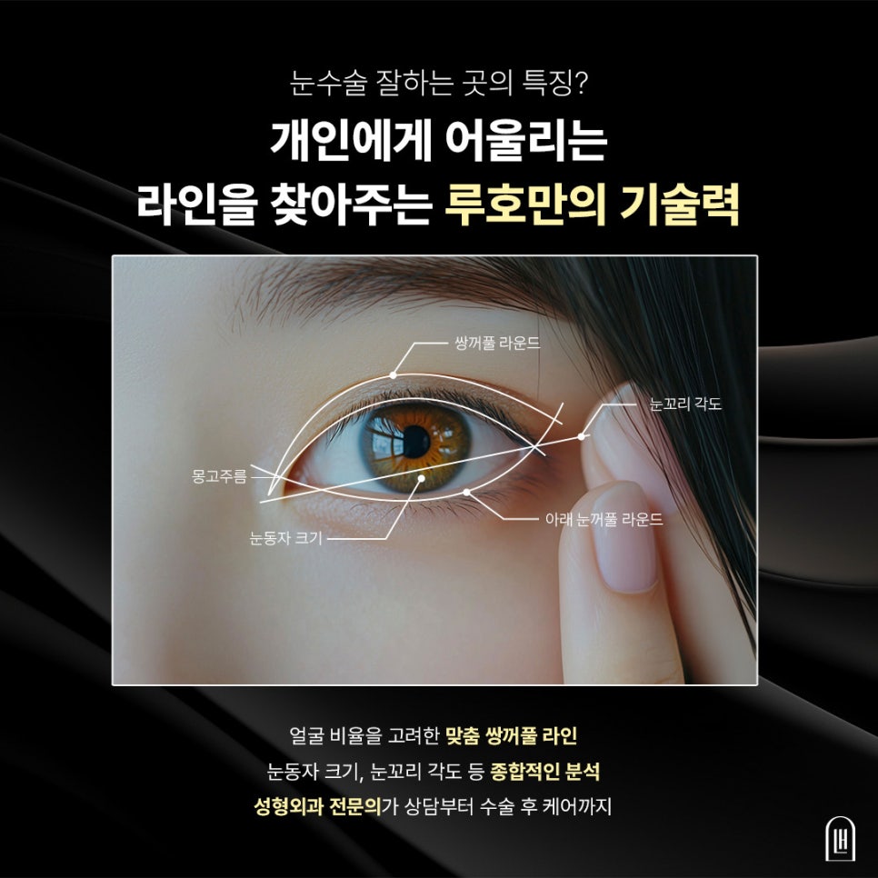 A Place Near Sinsa Station Known for Eye Surgery, Key Points for Improving the Eye Shape image 2