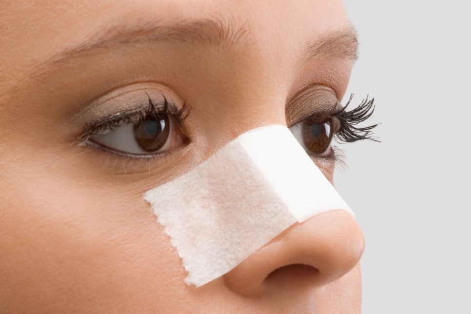 Sinsa Station Nose Plastic Surgery Clinic, Open vs. Closed Nose Surgery image 6