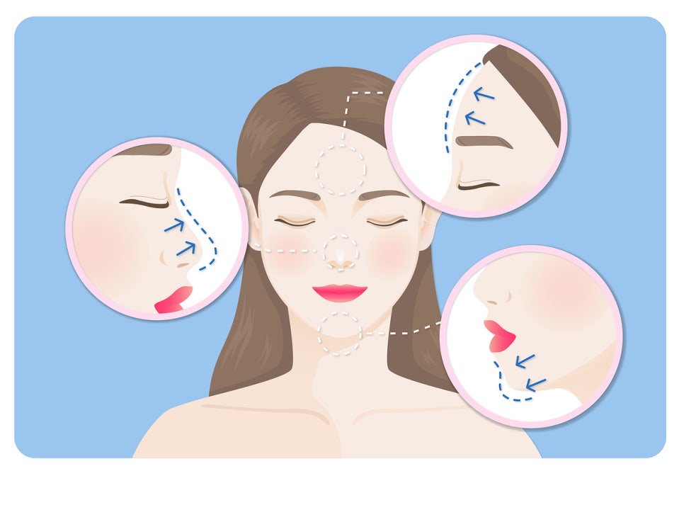 신사역 이마필러, 균형 잡힌 얼굴 원하신다면 관련 이미지 7