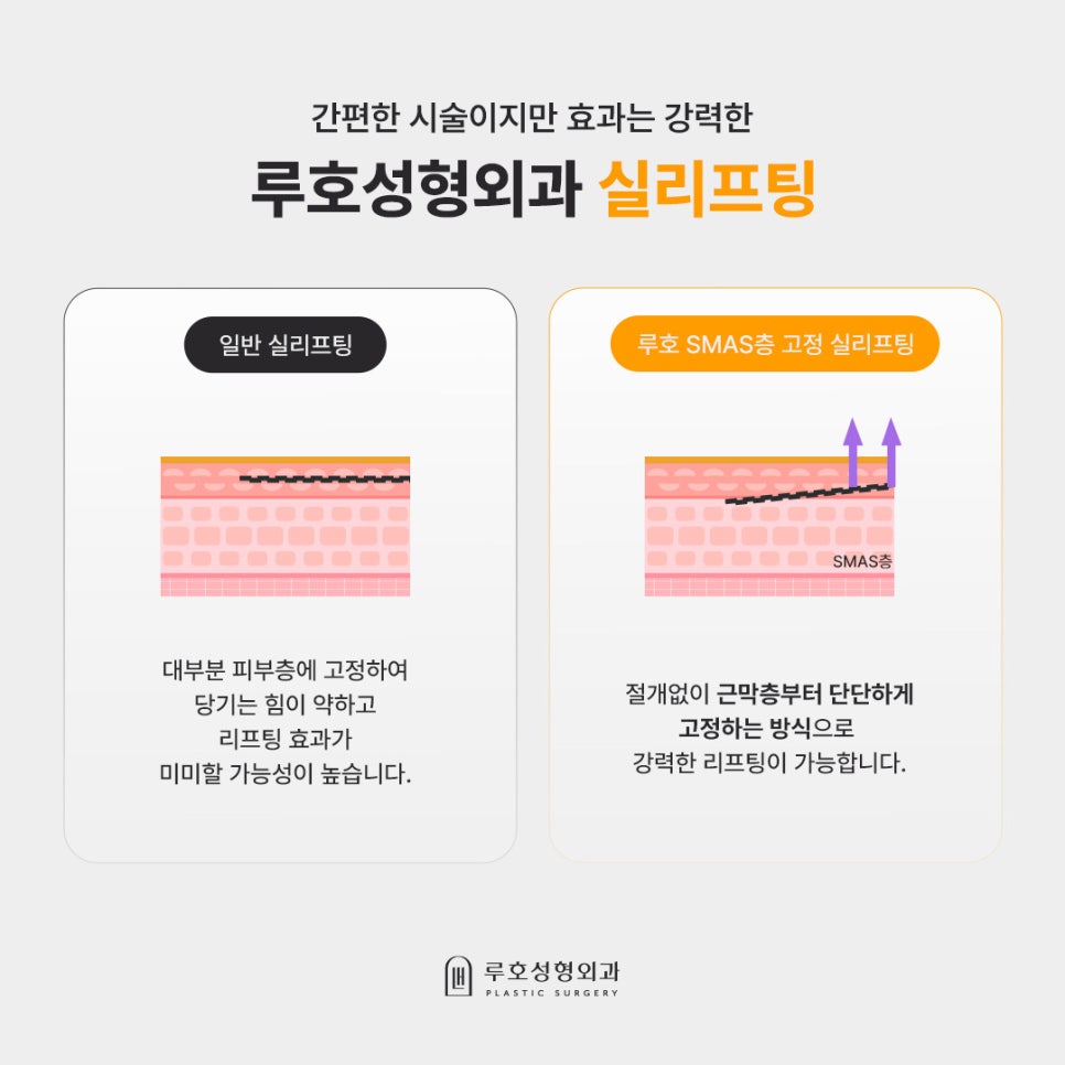 흩어진 균형과 라인을 동시에 잡은 신사역 성형외과 실리프팅 전후 관련 이미지 2