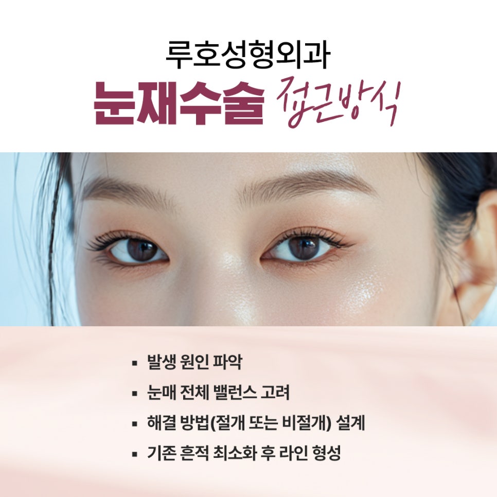 Sinnonhyeon Station Double Eyelid Revision Surgery for Faded Lines: Sharpening a Loose Line image 3
