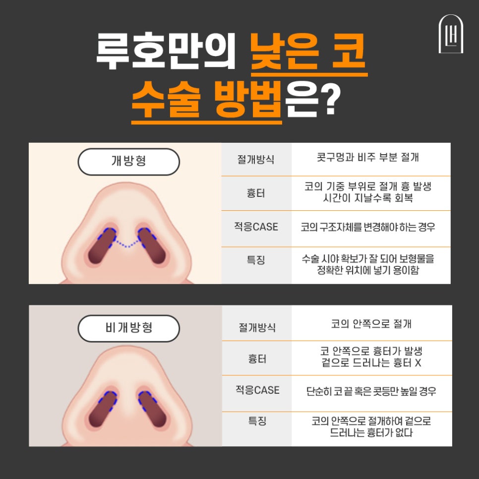 낮은 코 성형, 세련된 라인으로! 관련 이미지 4