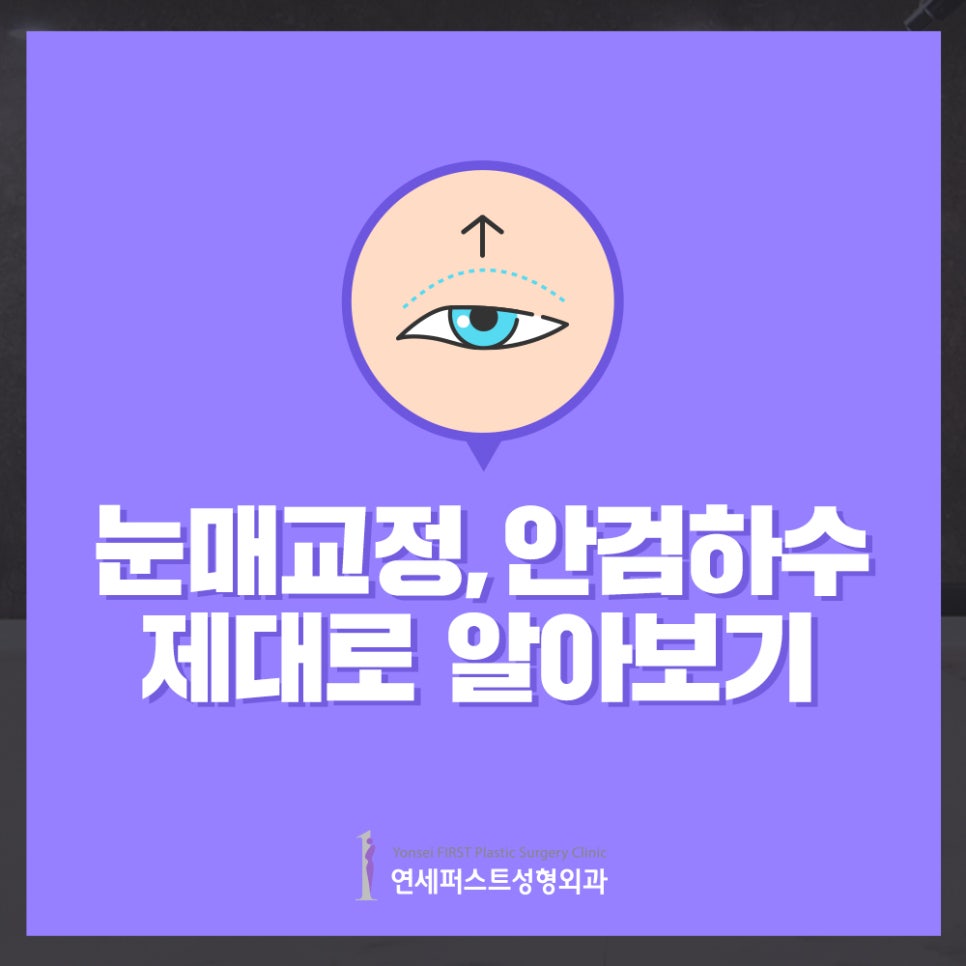 안검하수 제대로 알고 눈매교정 알아보자! 관련 이미지 1