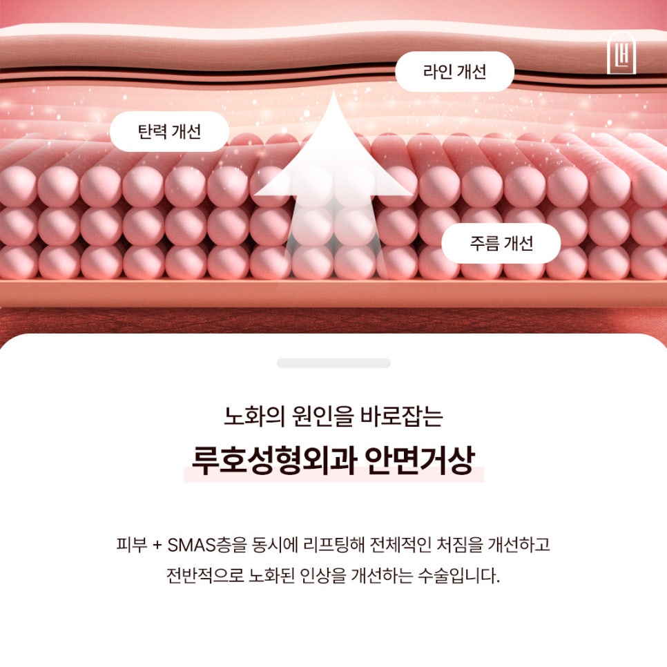 안면거상 전 알아야 할 3가지, 효과부터 흉터까지 관련 이미지 3