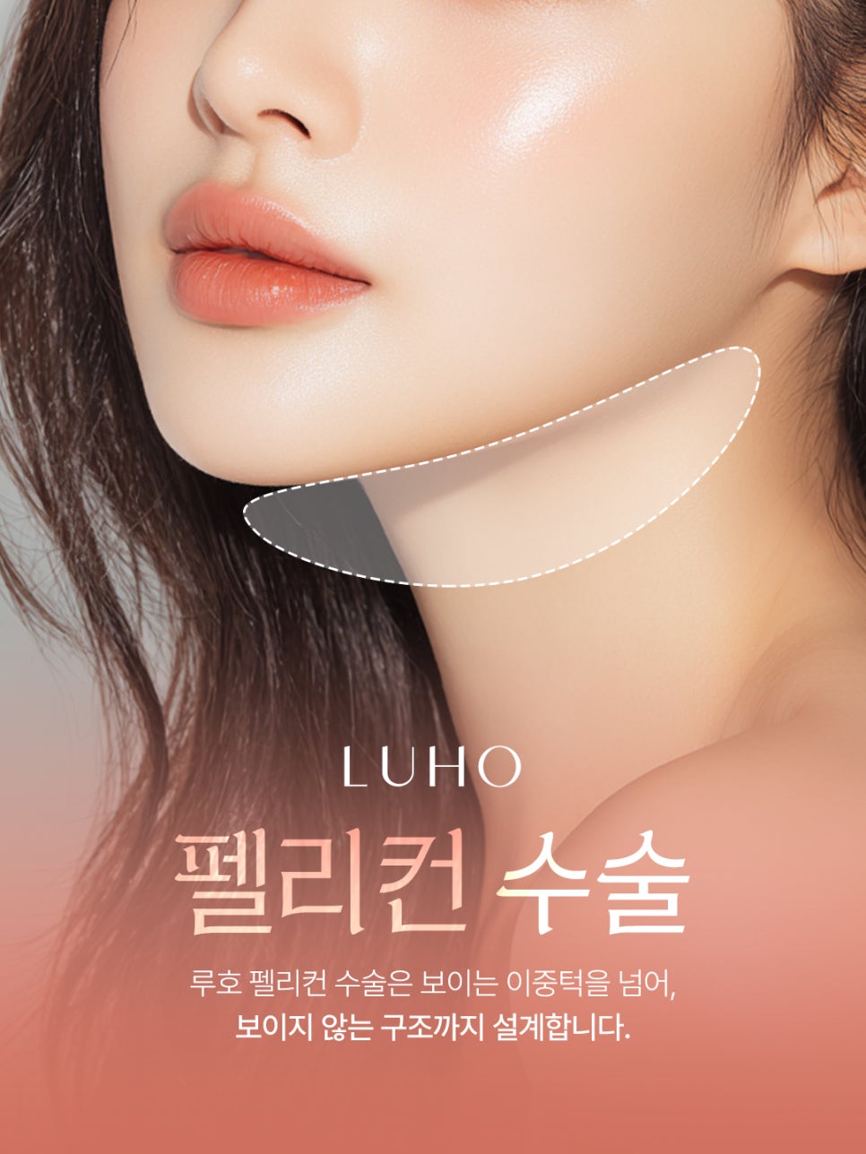 매끄러운 턱라인을 만든 신사역 펠리컨 수술 살펴보기 관련 이미지 2