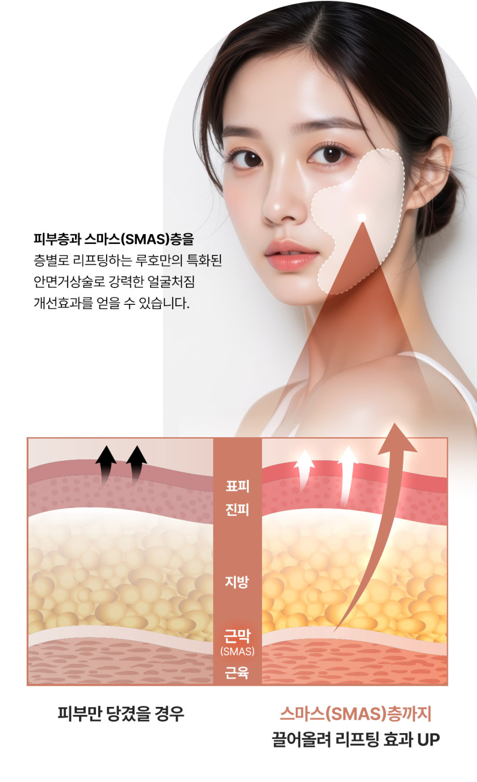 처진 얼굴선이 고민이었던 안면거상 사례 관련 이미지 2