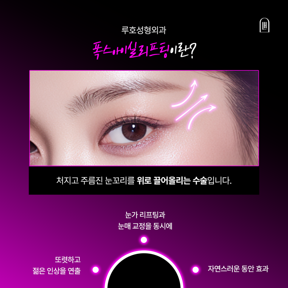 A More Open, Face-Appropriate Eye Shape After Outer-Corner Thread Lifting image 2