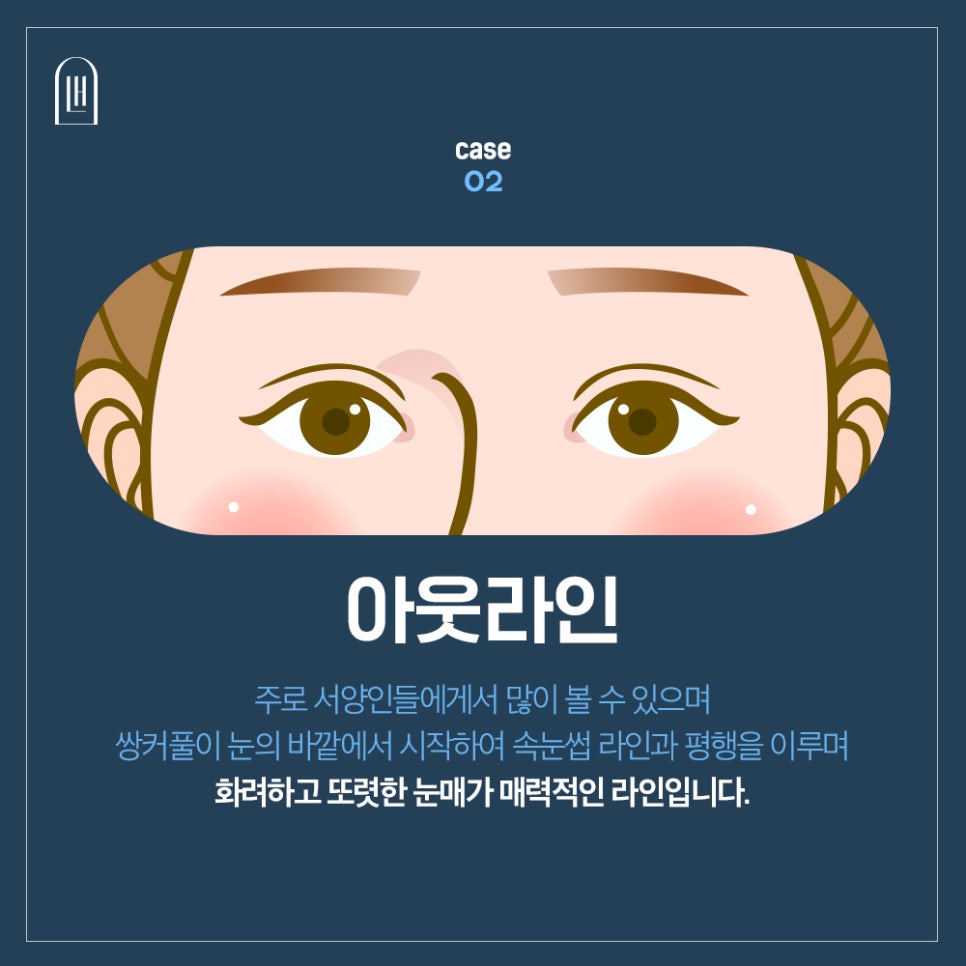 자연스러운 쌍수 인라인쌍커풀 하려면 관련 이미지 4
