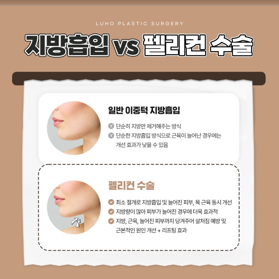 Luho Plastic Surgery Pelican Surgery to Regain a Hidden Jawline image 3