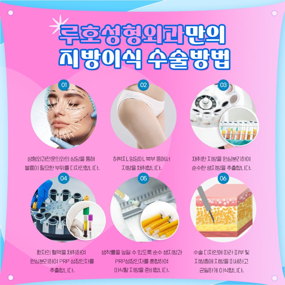 얼굴 볼륨을 살려주는 PRP 지방이식 관련 이미지 3